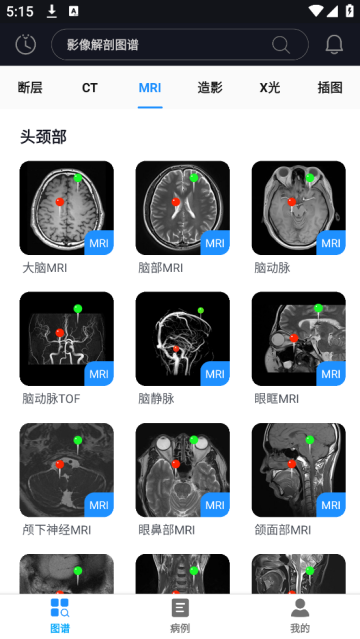 影像解剖图谱app